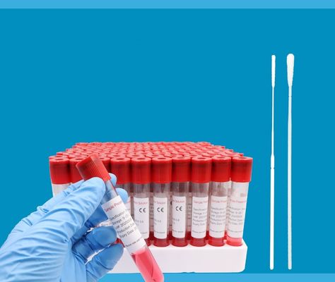 Tıbbi ABS Kan Örneği Tüpleri Ultra Yüksek Darbe Dayanımı